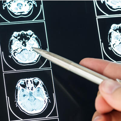 1556881879_neurosurgery.jpg