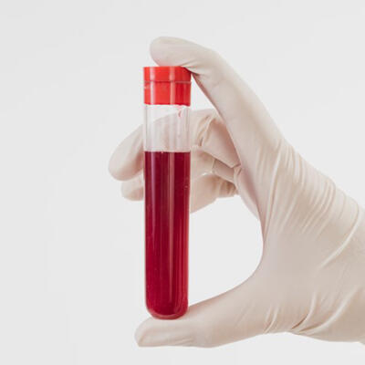 1556882533_blood-banks.jpg